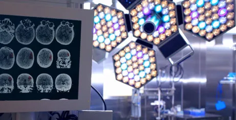 El EEG y cómo se realiza